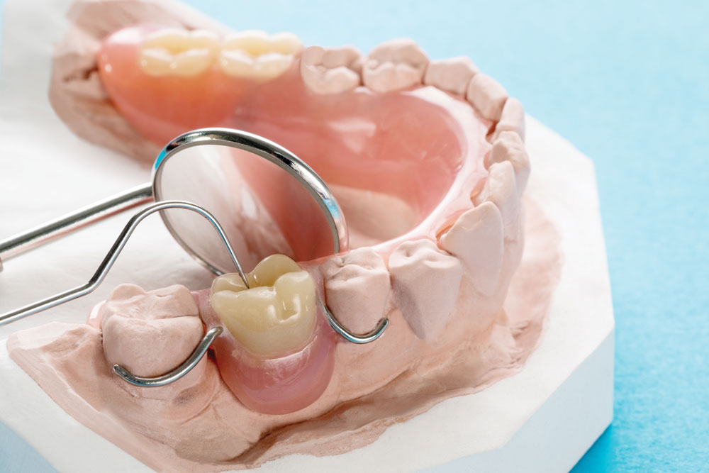 Full Partial Dentures Somerset NJ M NJ Family Implant Dentistry Full partial dentures somerset nj m nj family implant dentistry